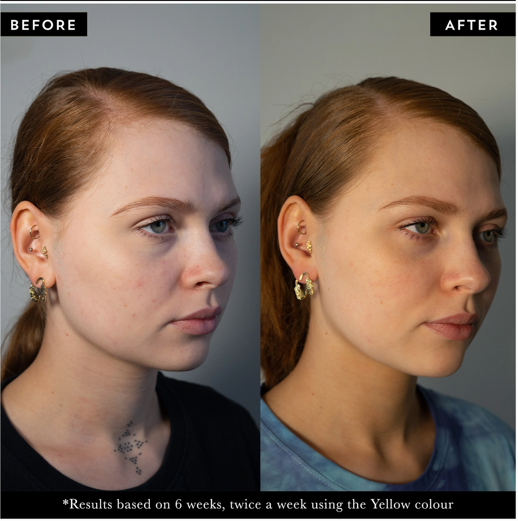 Photon Led Mask | Beauty Devices | Salon & Spa